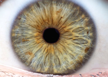 Iridology Iris #1 from Iridology Exam & Analysis Iridology analysis of Iris #1 from iridology exam.