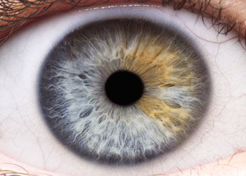 Iridology Iris #10 from Iridology Exam & Analysis Holistic iridology tells a lot from the analysis of this iris.