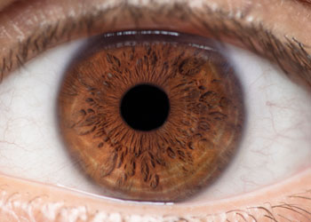 Iridology Iris #2 from Iridology Exam & Analysis Iridology analysis of Iris #2 from iridology exam.