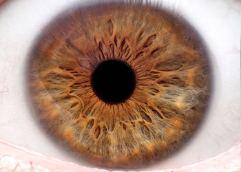 Iridology Iris #3 from Iridology Exam & Analysis Holistic iridology cured many ailments for this person.
