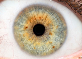 Iridology Iris #5 from Iridology Exam & Analysis Holistic iridology shows all the body's ailments and helps cure them.