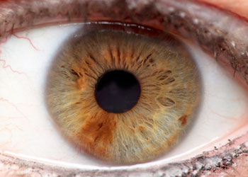 Iridology Iris #7 from Iridology Exam & Analysis This client was helped with the techniques from holistic iridology.