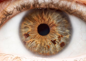 Iridology Iris #8 from Iridology Exam & Analysis Trust holistic iridology to identify physical, emotional, and mental ailments in the body.