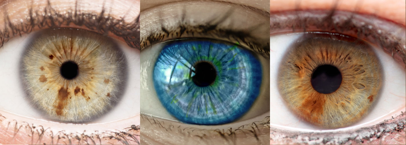 change your health through holistic iridology